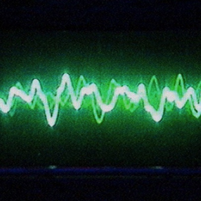 Video image of oscilloscope screen